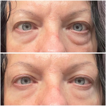 Eye Mask with Bio-Collagen, Peptide Complex & Vitamin C