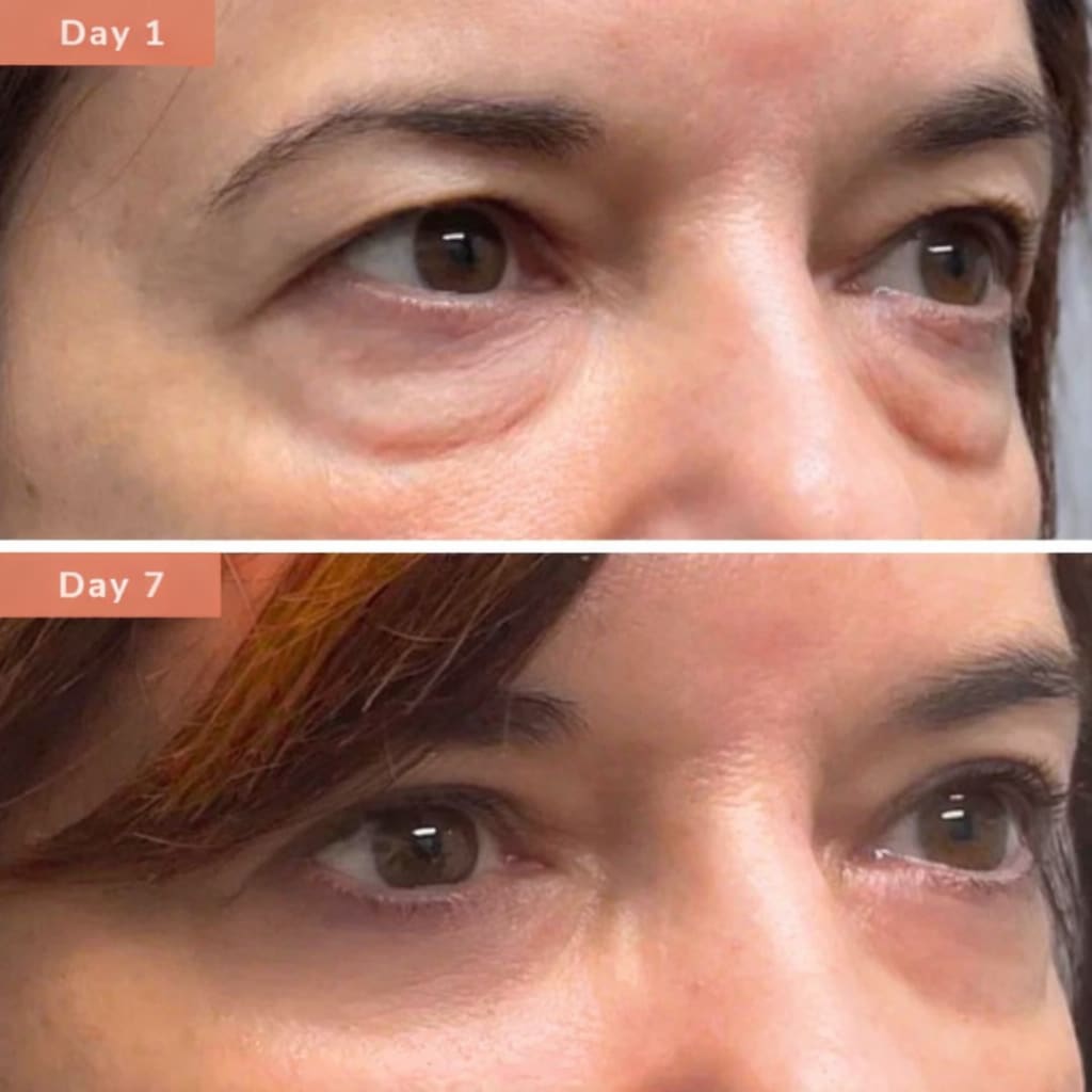 Eye Mask with Bio-Collagen, Peptide Complex & Vitamin C