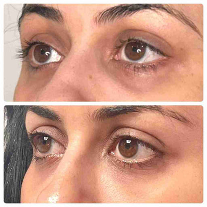 Eye Mask with Bio-Collagen, Peptide Complex & Vitamin C